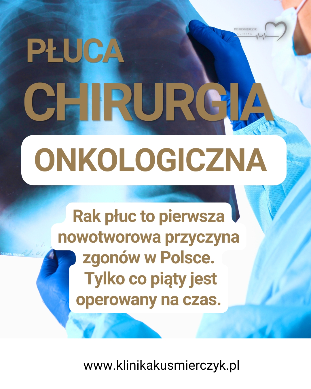 niskodawkowa tomografia płuc - wczesne wykrywanie raka płuca